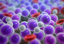 Acute Myeloid Leukaemia (AML) – My Story