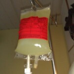 Bag of chemo. I don't think they could get anymore in there if they tried.