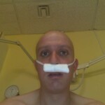 Taking the strain out of having a nose bleed. The auto-tissue.