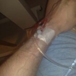 Saline infusion for when you are getting bit dehydrated from being sick all the time.